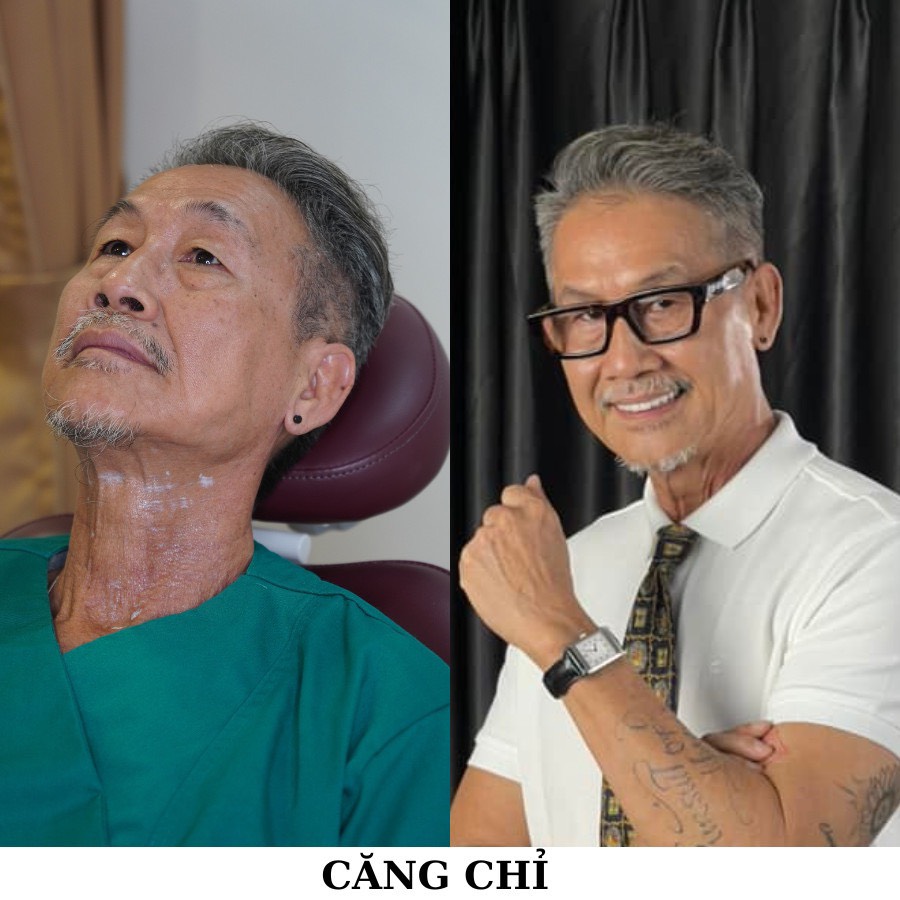 Mô tả hình